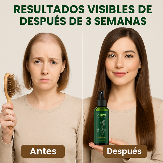 OUHOE® Spray Crecimiento del Cabello
